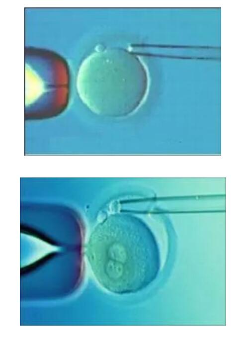 赴美生子费用深度解析与预算规划指南