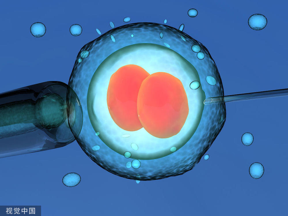 超声检查在不孕症诊断中的应用